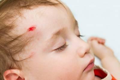 Aurora child injury lawyers